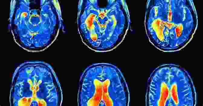 A Brain Scan Showing Different Areas Of Activity Cognitive Development And Cognitive Neuroscience: The Learning Brain