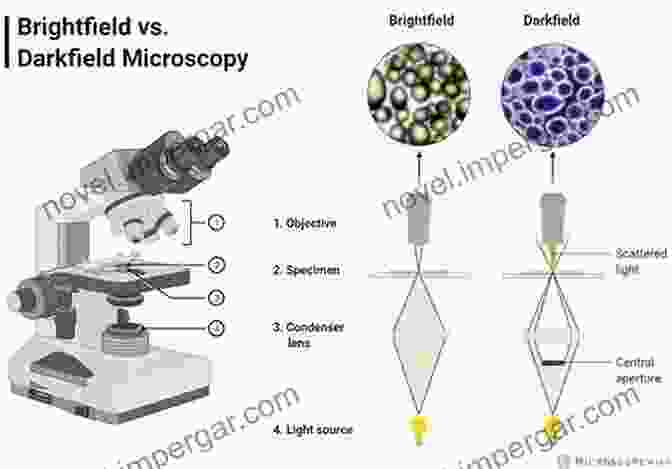 Comparison Of Brightfield And Darkfield Microscopy Images To Light Microscopy: Tips And Tricks For Beginners